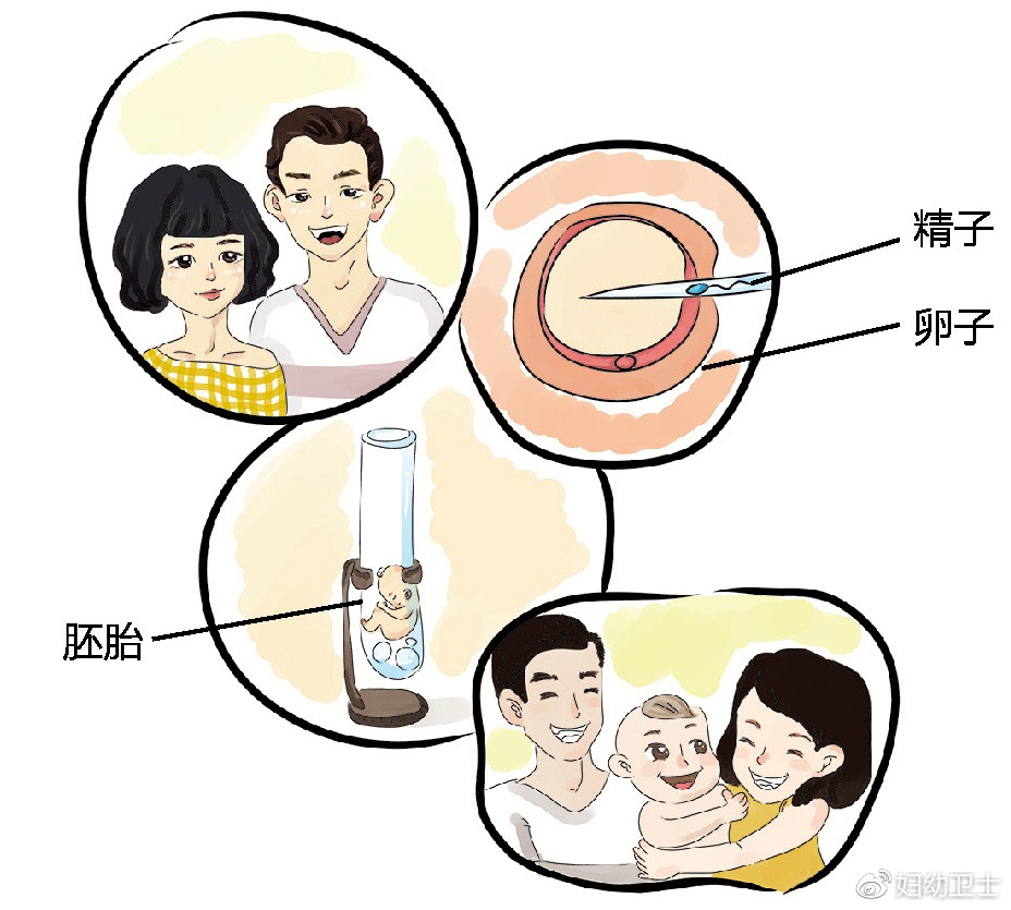 北京三院 试管婴儿