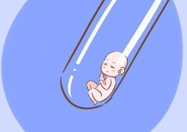海外试管婴儿