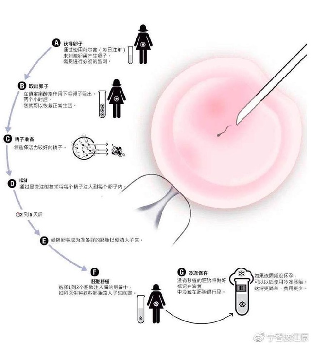 试管婴儿费用