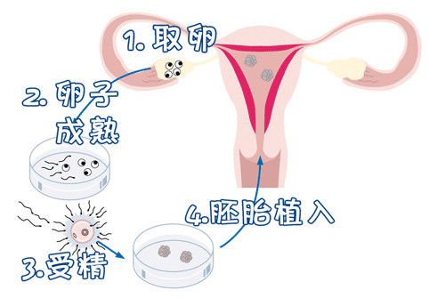 克罗米芬