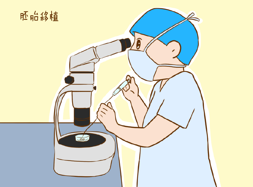 免疫性不孕