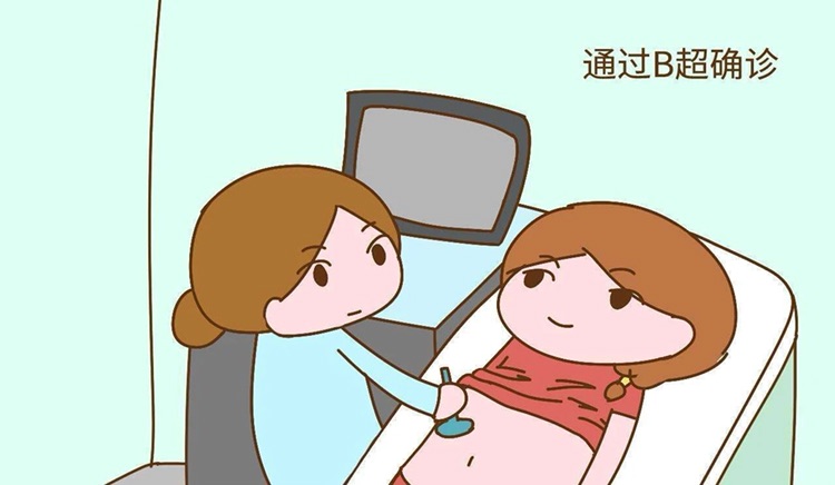 冷冻卵子