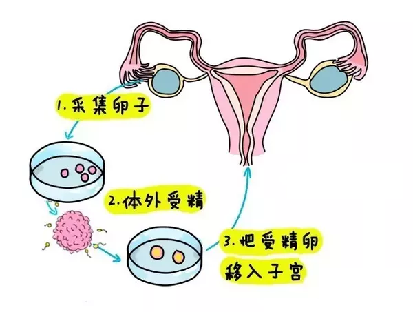 助孕