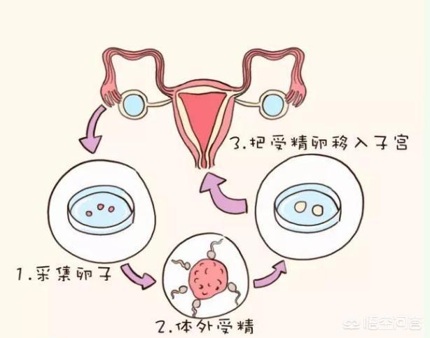 助孕方法